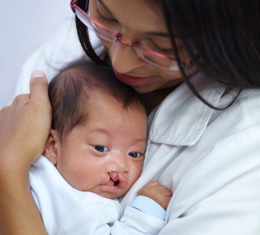 Cleft Lip and Palate